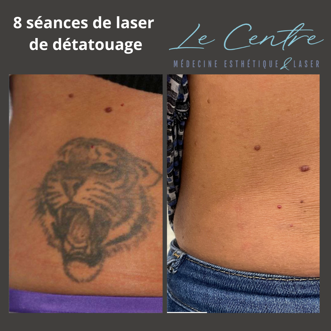 detatouage-tigre